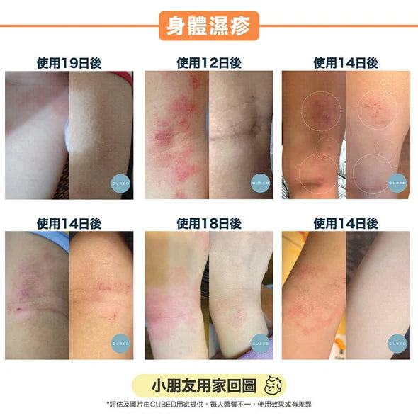 CUBED - 兒童濕疹紓緩護理油 Kids Body Oil 30ml