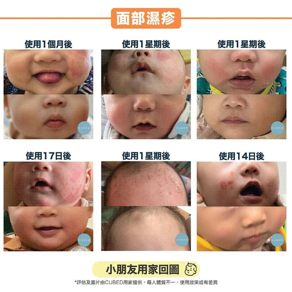 CUBED - 兒童濕疹紓緩護理油 Kids Body Oil 30ml
