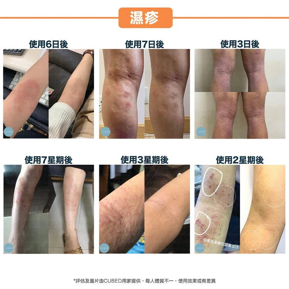 CUBED - 濕疹紓緩護理油 Body Oil 30ml