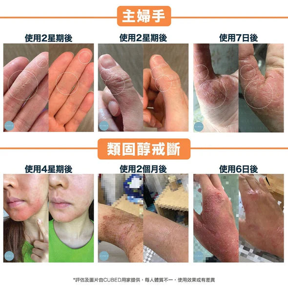 CUBED - 濕疹紓緩護理油 Body Oil 30ml