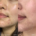 AXIS-Y - Spot The Difference Blemish Treatment 神經酰胺特效暗瘡液 15ml