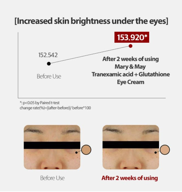 Mary & May - Tranexamic Acid+ Glutathione Eye Cream 傳明酸+穀胱甘肽美白補濕眼霜 30ml - 平行進口